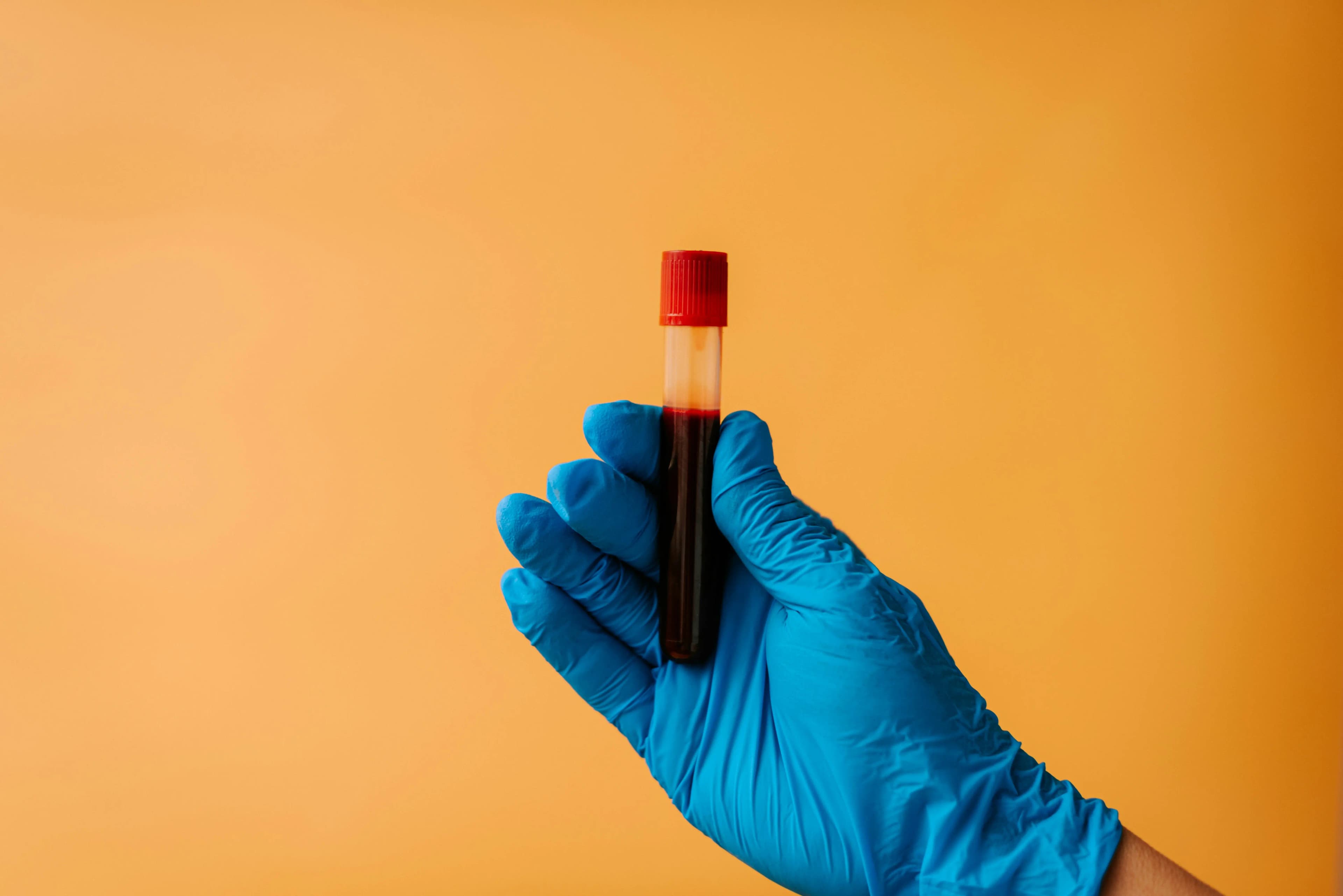 Labbesök och blodtrycksmätning